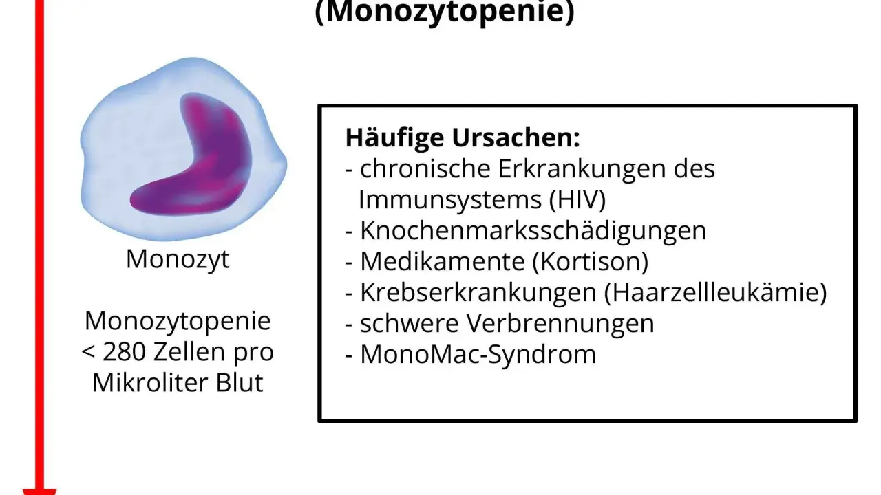 Bild zeigt einen Monozyten und erklärt, dass zu niedrige Monozyten (Monozytopenie) durch HIV, Medikamente oder schwere Verbrennungen verursacht werden können.