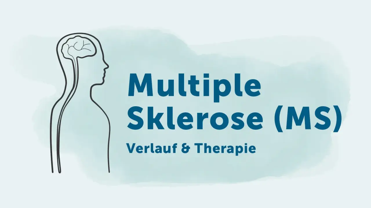 Grafik mit Gehirn und Körperumriss, die auf die Multiple Sklerose (MS) und ihre Diagnostik, Verlauf & Therapie hinweist.