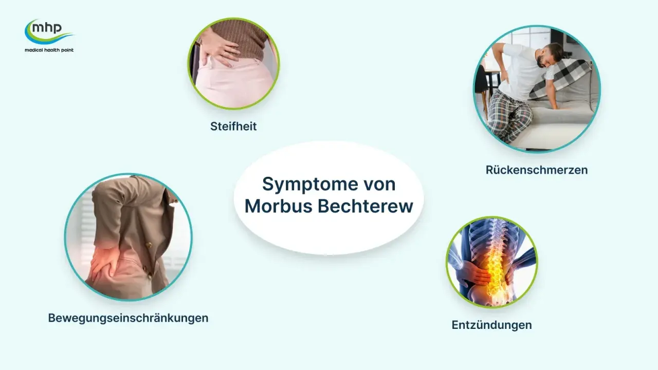 Symptome von Morbus Bechterew: Steifheit, Rückenschmerzen, Bewegungseinschränkungen und Entzündungen der Wirbelsäule.