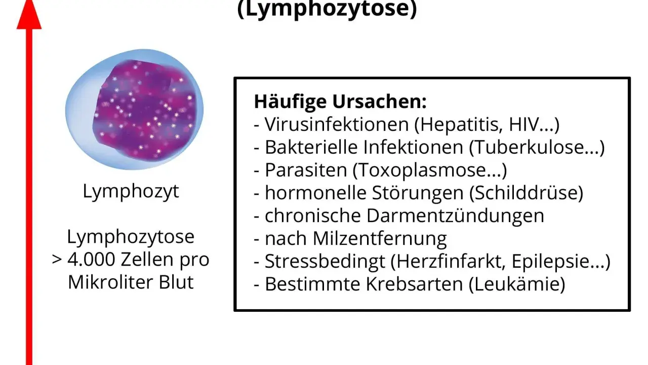 Erhöhte Lymphozyten (Lymphozytose) über 4.000/µl Blut. Ursachen: Infektionen, Parasiten, hormonelle Störungen, Stress, Krebs.