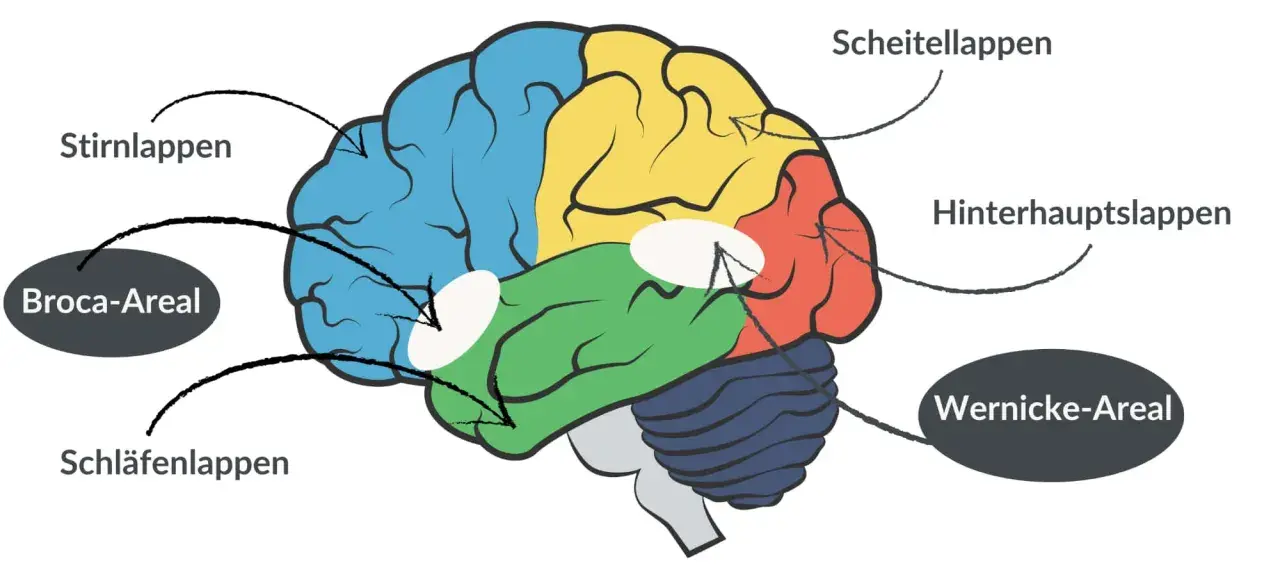 Gehirn mit farbigen Lappen und Markierungen für Broca-Areal und Wernicke-Areal, wichtig für das Verständnis von Broca-Wernicke-Aphasie.
