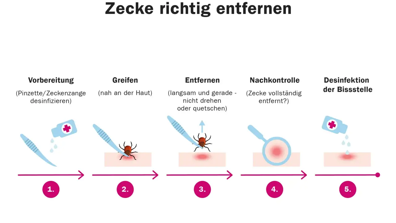 Schritt-für-Schritt-Anleitung zur zecke entfernen: Vorbereitung, Greifen, Entfernen, Nachkontrolle und Desinfektion der Bissstelle.