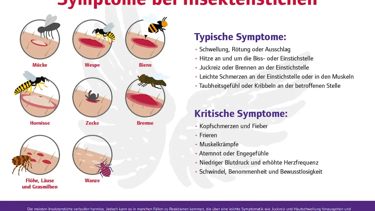 Bienenstich was tun? Die Grafik zeigt Symptome von Insektenstichen wie Schwellung, Juckreiz und Schmerzen. Bei kritischen Symptomen wie Atemnot sofort Arzt rufen.