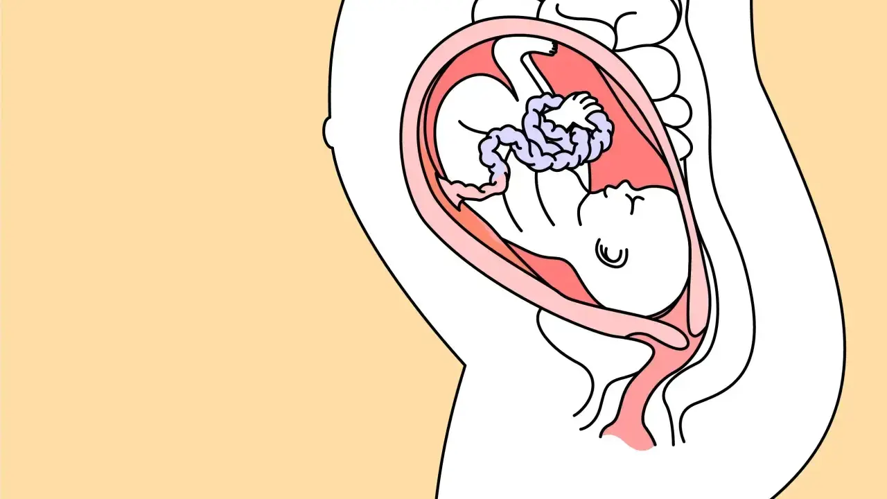 Schnittzeichnung einer schwangeren Frau, die das Baby in der Gebärmutter zeigt. Das Baby ist in der 28. SSW und entwickelt sich gut.