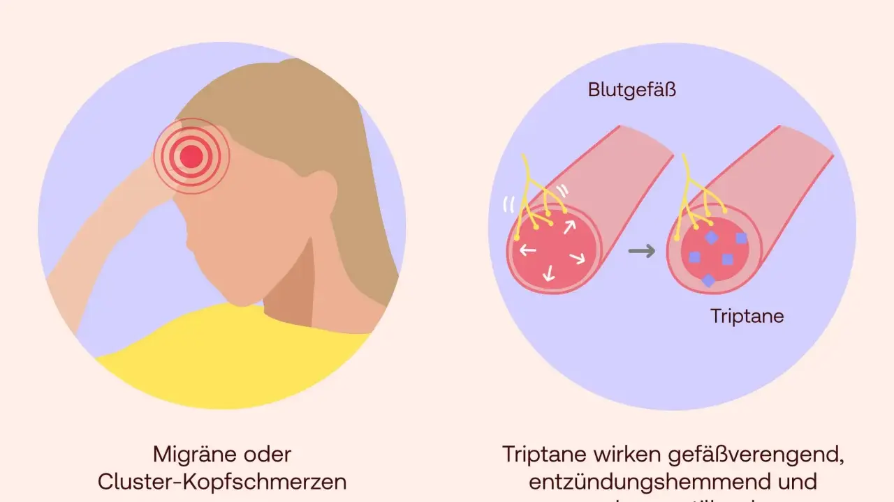 Triptane helfen bei Migräne, indem sie Blutgefäße verengen, Entzündungen hemmen und Schmerzen lindern.
