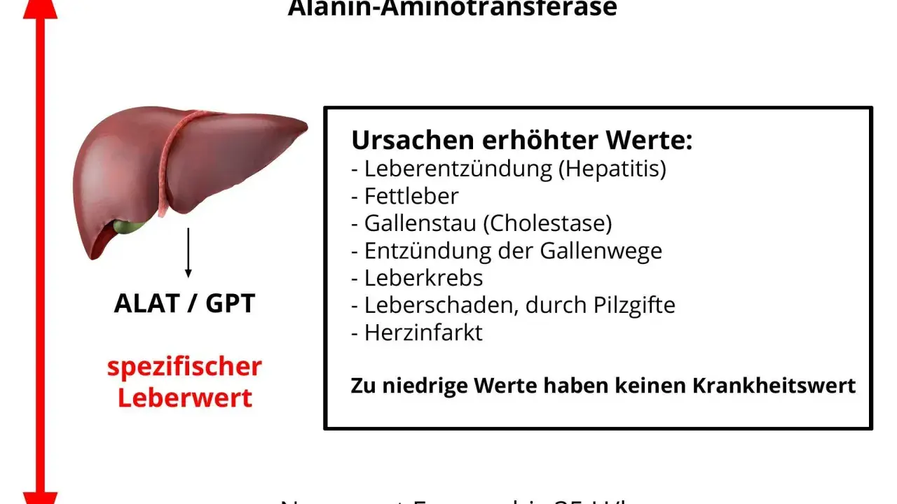 Leberwert ALAT/GPT, ein spezifischer Leberwert, kann bei Hepatitis, Fettleber oder anderen Ursachen erhöht sein. Niedrige Werte sind irrelevant.