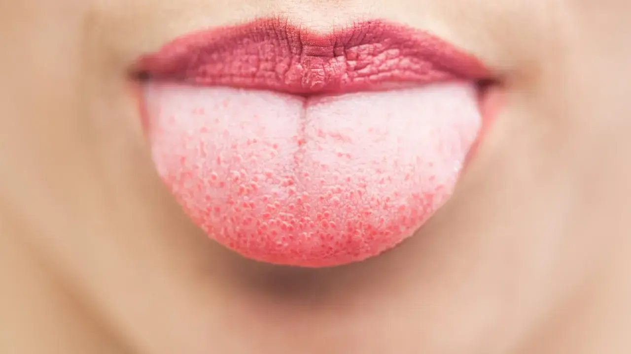Nahaufnahme einer Zunge mit einem leichten, rosafarbenen belag auf der zunge. Die Lippen sind leicht geöffnet.