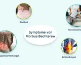 Symptome von Morbus Bechterew: Steifheit, Rückenschmerzen, Bewegungseinschränkungen und Entzündungen der Wirbelsäule.