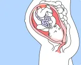 Ein Baby in 35 ssw liegt mit dem Kopf nach unten im Mutterleib, bereit für die Geburt.