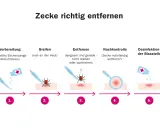 Schritt-für-Schritt-Anleitung zur zecke entfernen: Vorbereitung, Greifen, Entfernen, Nachkontrolle und Desinfektion der Bissstelle.