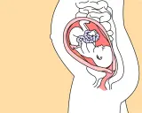 Schnittzeichnung einer schwangeren Frau, die das Baby in der Gebärmutter zeigt. Das Baby ist in der 28. SSW und entwickelt sich gut.