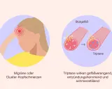 Triptane helfen bei Migräne, indem sie Blutgefäße verengen, Entzündungen hemmen und Schmerzen lindern.
