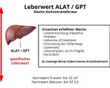 Leberwert ALAT/GPT, ein spezifischer Leberwert, kann bei Hepatitis, Fettleber oder anderen Ursachen erhöht sein. Niedrige Werte sind irrelevant.