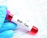 Blauer Handschuh hält Blutprobe für BNP-Test. Laborbericht im Hintergrund zeigt verschiedene Werte, darunter auch den BNP Wert.