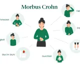 Symptome von Morbus Crohn: Bauchschmerzen, Müdigkeit, Blut im Stuhl, Durchfall, Fieber, Erbrechen, Gewichtsverlust.