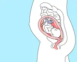Ein Baby in der 25. SSW liegt im Mutterleib, umgeben von der Nabelschnur und der Fruchtblase.