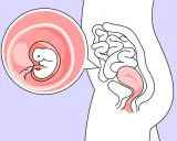 Ein Embryo in der 6. SSW wächst in der Gebärmutter. Der kleine Mensch entwickelt sich rasant.