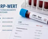 Blutprobe für CRP-Test, zeigt Entzündungswerte wie Leukozyten und BSG. Der CRP-Wert ist 28,4 mg/l.