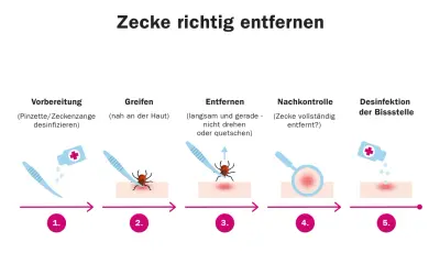 Schritt-für-Schritt-Anleitung zur zecke entfernen: Vorbereitung, Greifen, Entfernen, Nachkontrolle und Desinfektion der Bissstelle.
