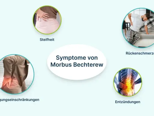 Symptome von Morbus Bechterew: Steifheit, Rückenschmerzen, Bewegungseinschränkungen und Entzündungen der Wirbelsäule.