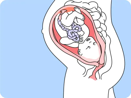 Ein Baby in 35 ssw liegt mit dem Kopf nach unten im Mutterleib, bereit für die Geburt.