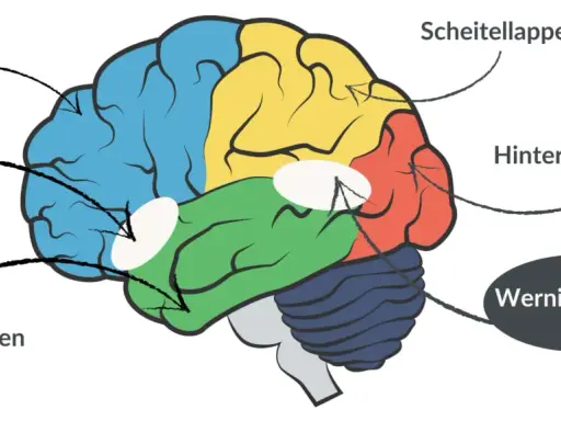 Gehirn mit farbigen Lappen und Markierungen für Broca-Areal und Wernicke-Areal, wichtig für das Verständnis von Broca-Wernicke-Aphasie.