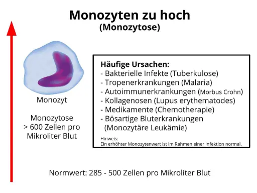 Erhöhte Monozyten (Monozytose) können auf Infektionen, Autoimmunerkrankungen oder bösartige Blutkrankheiten hinweisen. Der Normwert liegt bei 285-500 Zellen/µl.