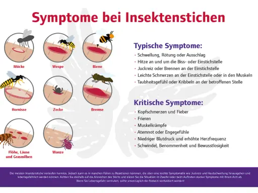 Bienenstich was tun? Die Grafik zeigt Symptome von Insektenstichen wie Schwellung, Juckreiz und Schmerzen. Bei kritischen Symptomen wie Atemnot sofort Arzt rufen.