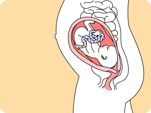 Schnittzeichnung einer schwangeren Frau, die das Baby in der Gebärmutter zeigt. Das Baby ist in der 28. SSW und entwickelt sich gut.