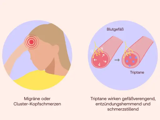 Triptane helfen bei Migräne, indem sie Blutgefäße verengen, Entzündungen hemmen und Schmerzen lindern.