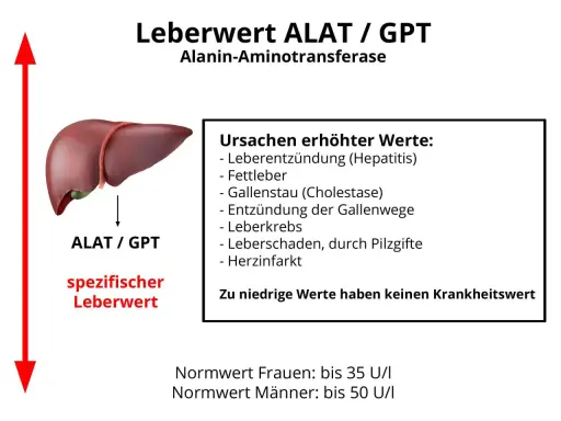 Leberwert ALAT/GPT, ein spezifischer Leberwert, kann bei Hepatitis, Fettleber oder anderen Ursachen erhöht sein. Niedrige Werte sind irrelevant.