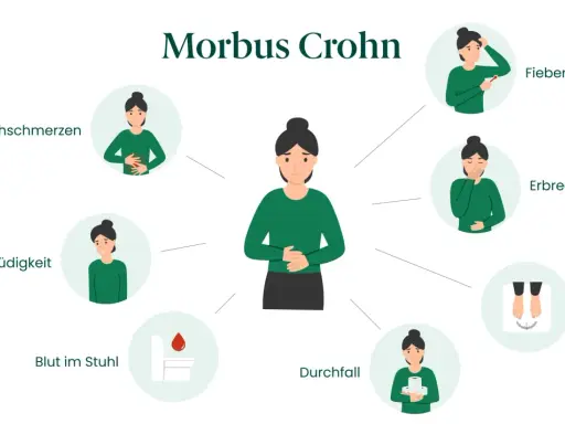 Symptome von Morbus Crohn: Bauchschmerzen, Müdigkeit, Blut im Stuhl, Durchfall, Fieber, Erbrechen, Gewichtsverlust.