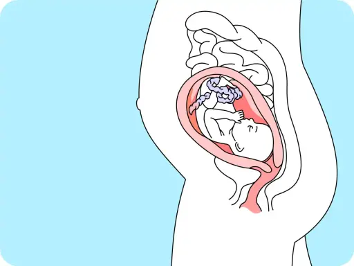 Ein Baby in der 25. SSW liegt im Mutterleib, umgeben von der Nabelschnur und der Fruchtblase.