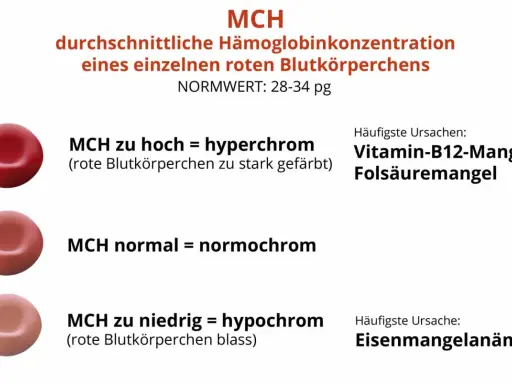 MCH-Wert: rote Blutkörperchen können hyperchrom (zu stark gefärbt), normochrom oder hypochrom (blass) sein. Ursachen für MCH-Abweichungen sind u.a. Vitaminmangel oder Eisenmangelanämie.
