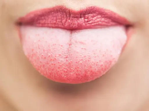 Nahaufnahme einer Zunge mit einem leichten, rosafarbenen belag auf der zunge. Die Lippen sind leicht geöffnet.