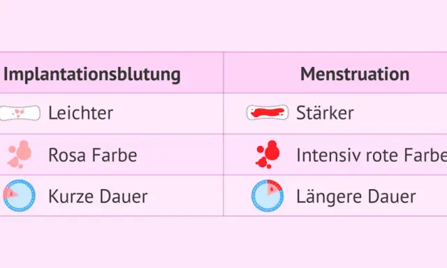 Vergleich: Einistungsblutung vs. Menstruation. Wann tritt sie auf? Leichter, rosa, kurz vs. stärker, rot, länger.
