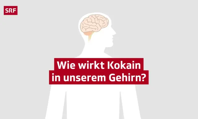 Gehirn-Illustration mit Text: Wie wirkt Kokain in unserem Gehirn? SRF.