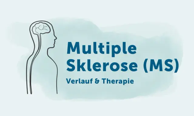 Grafik mit Gehirn und Körperumriss, die auf die Multiple Sklerose (MS) und ihre Diagnostik, Verlauf & Therapie hinweist.
