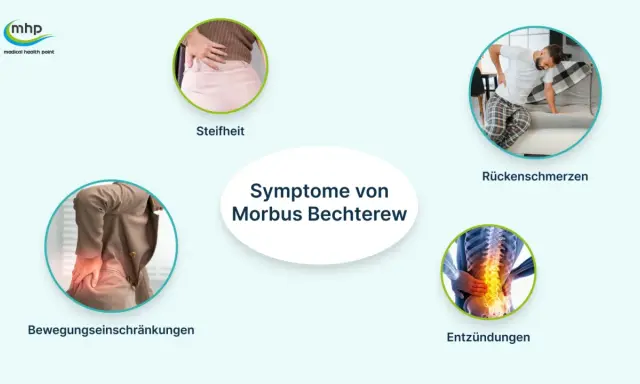 Symptome von Morbus Bechterew: Steifheit, Rückenschmerzen, Bewegungseinschränkungen und Entzündungen der Wirbelsäule.