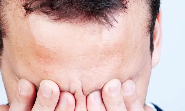 Mann mit Händen vor dem Gesicht, Stirn gerunzelt, als ob er den **exitus letalis** fürchtet.