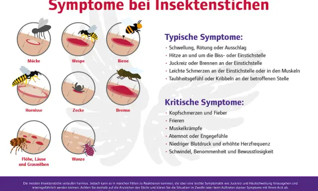 Bienenstich was tun? Die Grafik zeigt Symptome von Insektenstichen wie Schwellung, Juckreiz und Schmerzen. Bei kritischen Symptomen wie Atemnot sofort Arzt rufen.