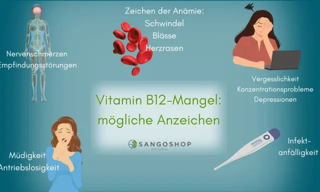 Vitamin B12-Mangel kann zu neurologische Symptome wie Nervenschmerzen, Empfindungsstörungen, Müdigkeit, Vergesslichkeit und Konzentrationsproblemen führen.