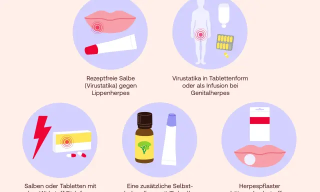 Rezeptfreie Salbe, Virustatika, Salben mit Diclofenac, Zinksalbe, Teebaumöl und Herpespflaster – diese Mittel helfen gegen Herpes.