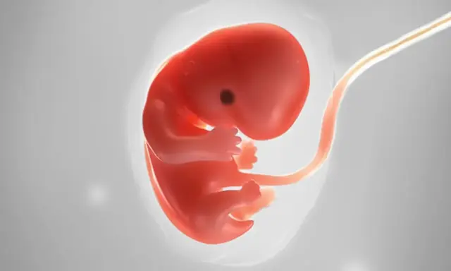 Ein roter Embryo mit Nabelschnur, dargestellt als Ultraschall 7 ssw.