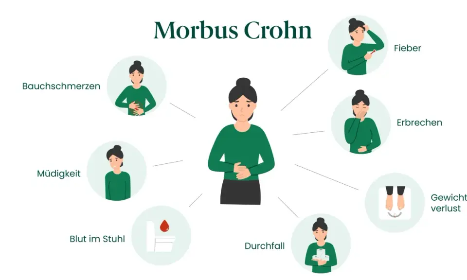 Symptome von Morbus Crohn: Bauchschmerzen, Müdigkeit, Blut im Stuhl, Durchfall, Fieber, Erbrechen, Gewichtsverlust.