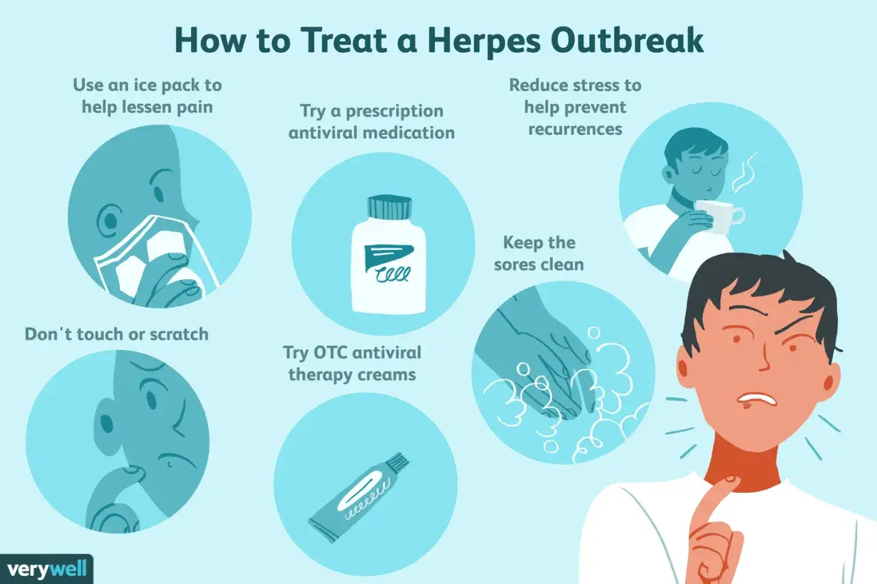 Was hilft gegen Herpes? Eispack, nicht kratzen, antivirale Cremes, Medikamente, Stress reduzieren und Wunden sauber halten.