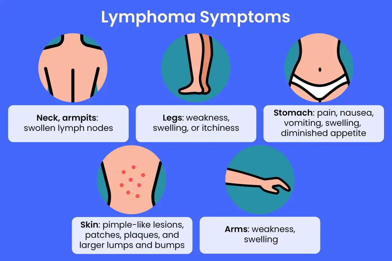 Übersicht der Lymphom-Symptome: geschwollene Lymphknoten im Hals/Achseln, Hautveränderungen, Magenbeschwerden, Schwäche in Armen/Beinen.