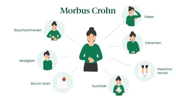 Symptome von Morbus Crohn: Bauchschmerzen, Müdigkeit, Blut im Stuhl, Durchfall, Fieber, Erbrechen, Gewichtsverlust.